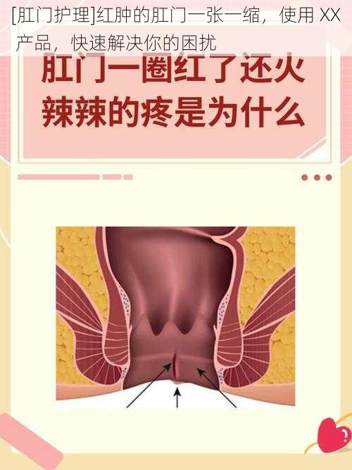 [肛门护理]红肿的肛门一张一缩，使用 XX 产品，快速解决你的困扰